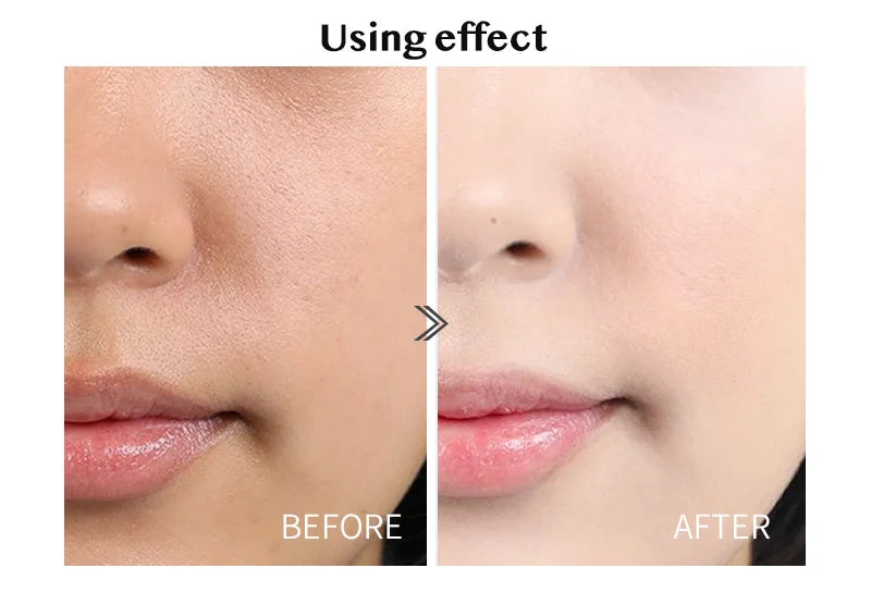 28 Bottles Skincare Revitalizer Hyaluronic Acid Ampoule Essence - Moisturizing & Pore Shrinking Facial Serum