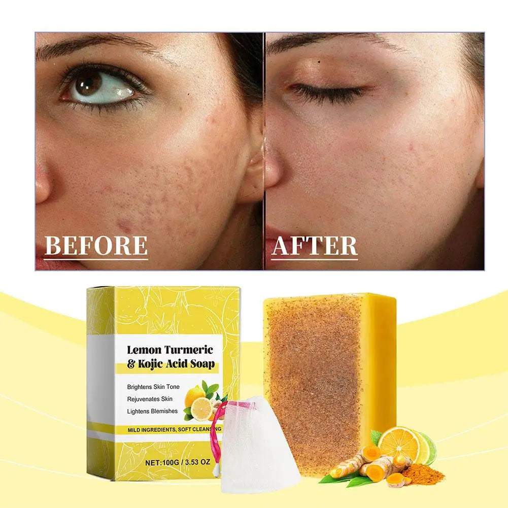 Lemon & Turmeric Kojic Acid Soap Bar – Brightening & Firming Face & Body Wash for Glowing Skin