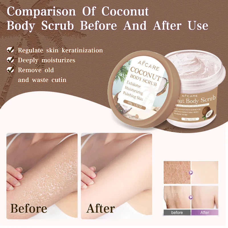 🥥 Coconut Scrub Exfoliating Body Scrub – Polishing Collagen Body & Foot Scrub for Skin Whitening & Dead Skin Removal! ✨